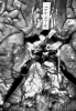 Basilar artery thrombosis